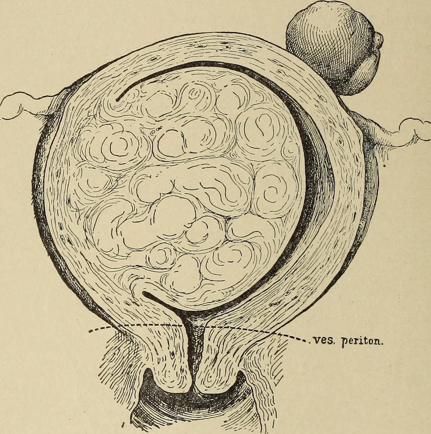 Gynecological diagnosis (1910) (14754993626).jpg