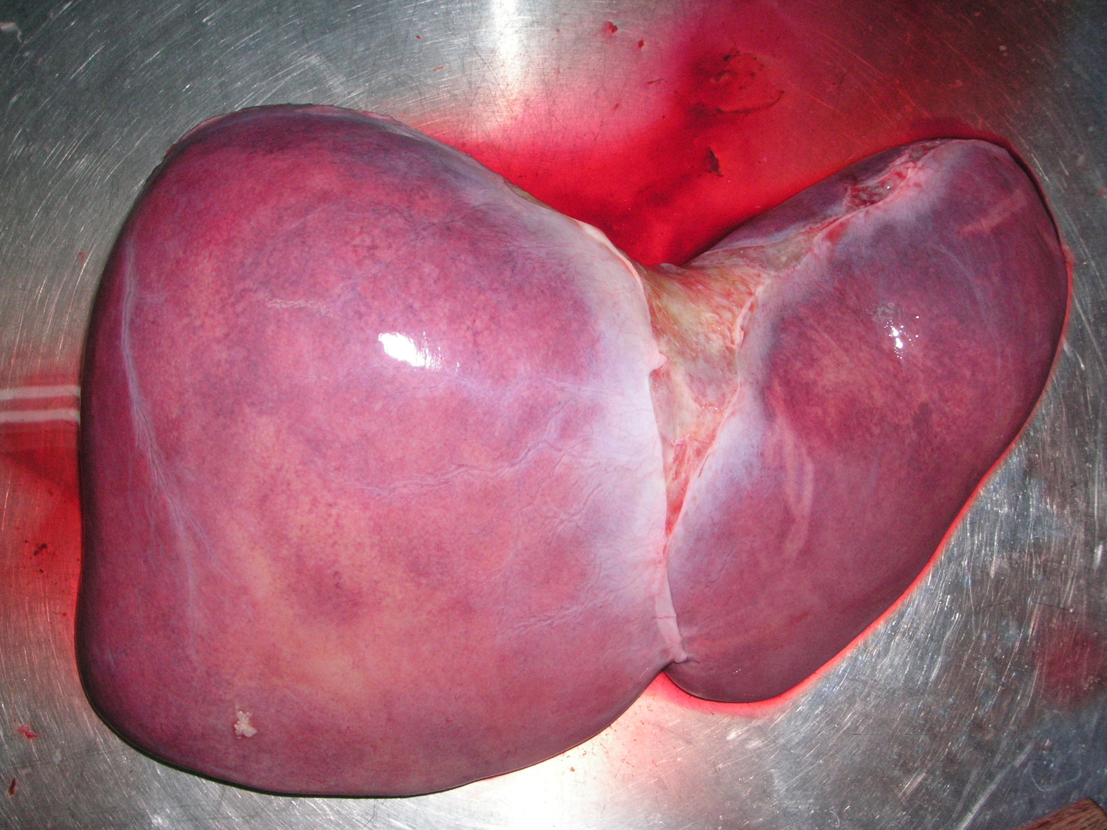 human liver picture