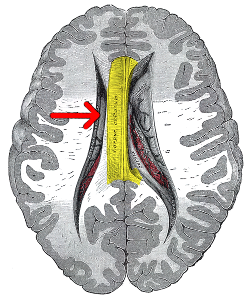 File:Gray 737-emphasizing-corpus-callosum.png