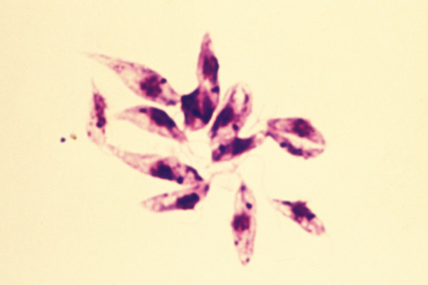 File:Leishmania tropica 7.jpg