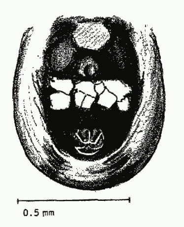 File:Theridion.attritum.ventral.png