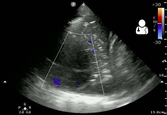 File:UOTW 28 - Ultrasound of the Week 4.jpg