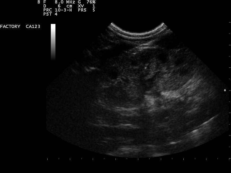 File:Ultrasound Scan ND 110131164227 1648360.jpg