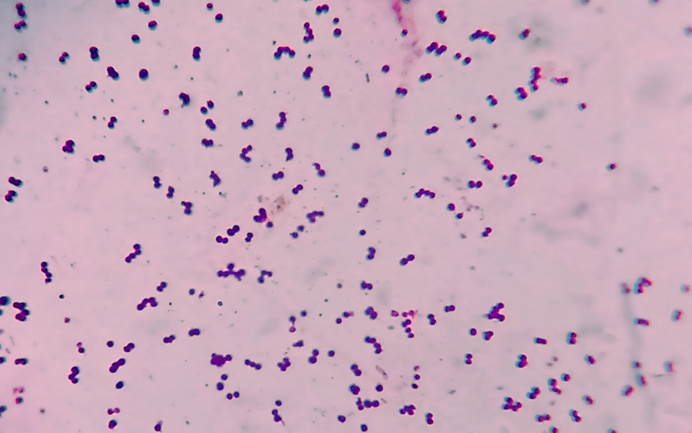 gram positive diplococci