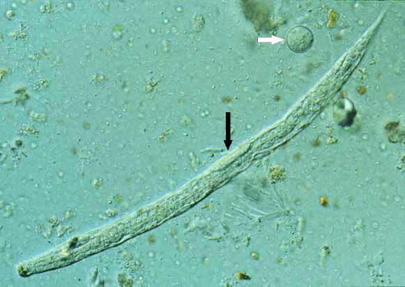 File:Strongyl larva1 DPDx.jpg