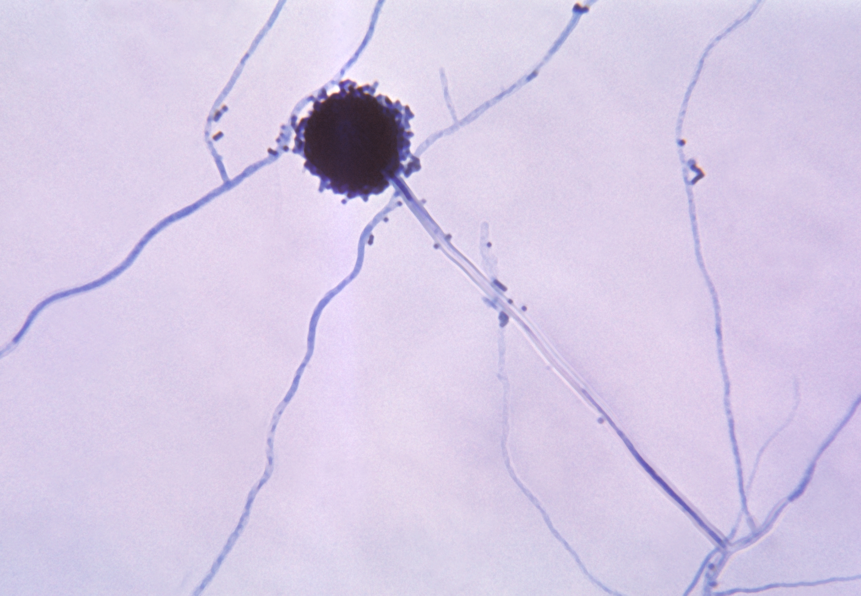 labelled aspergillus niger under microscope
