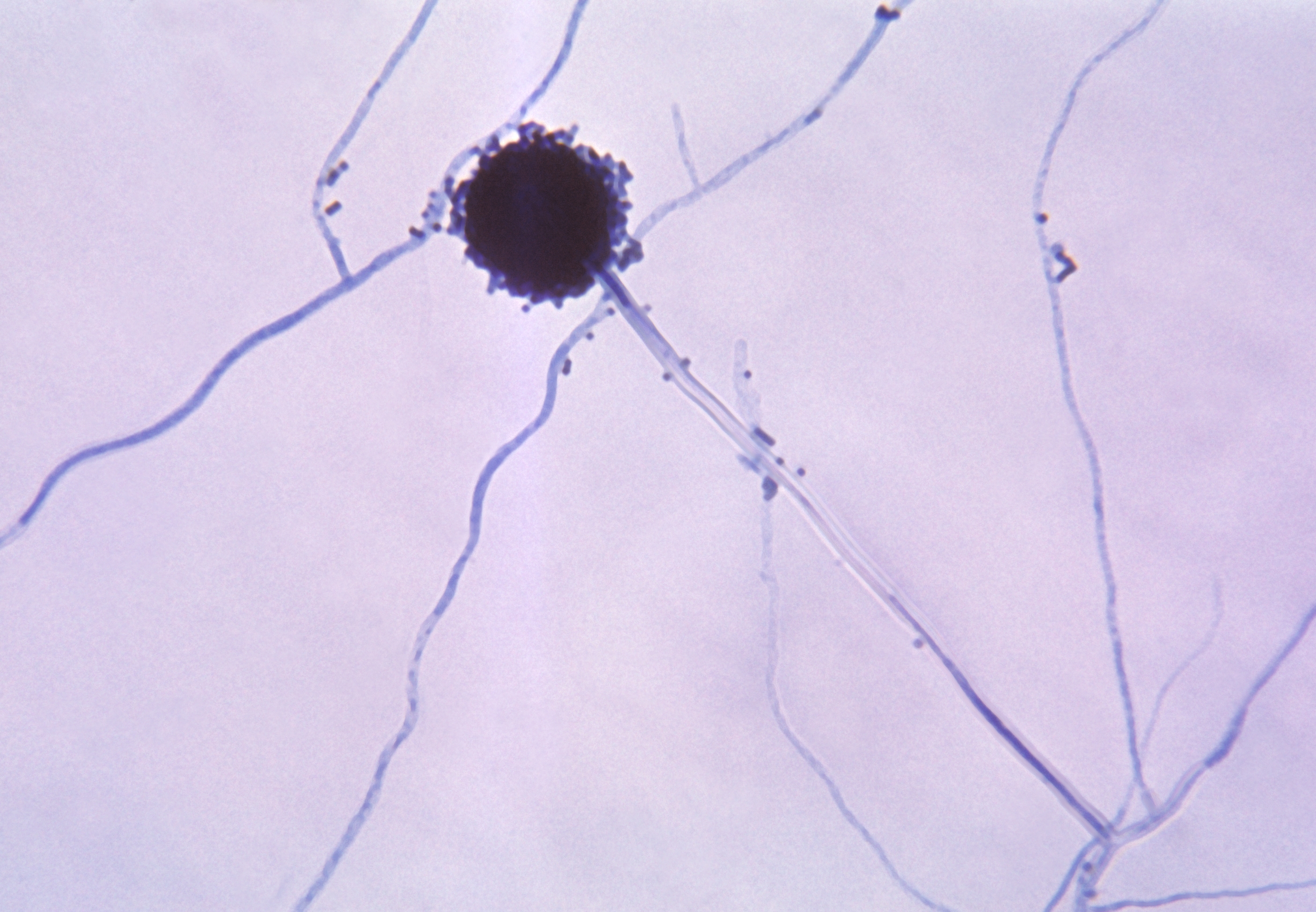 aspergillus niger structure