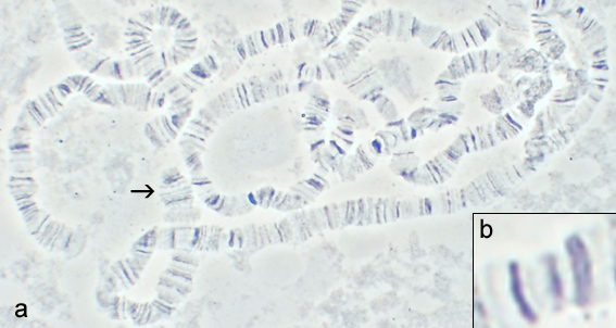 File:Drosophila polytene chromosomes 2.jpg