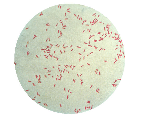 File:Pseudomonas aeruginosa gram.jpg