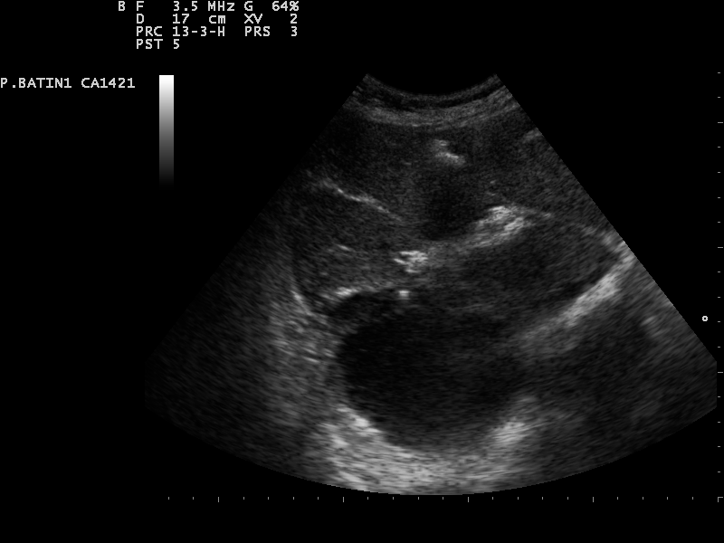 File:Ultrasound Scan ND 0124114532 1150250.png