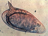 Žarnyno šistosomos Schistosoma mansoni kiaušinis