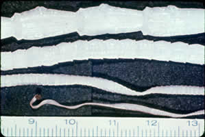 Rinderbandwurm (Taenia saginata)