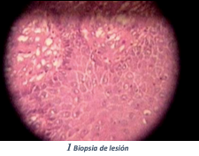 Kleibsiella Granulomatis 4.png