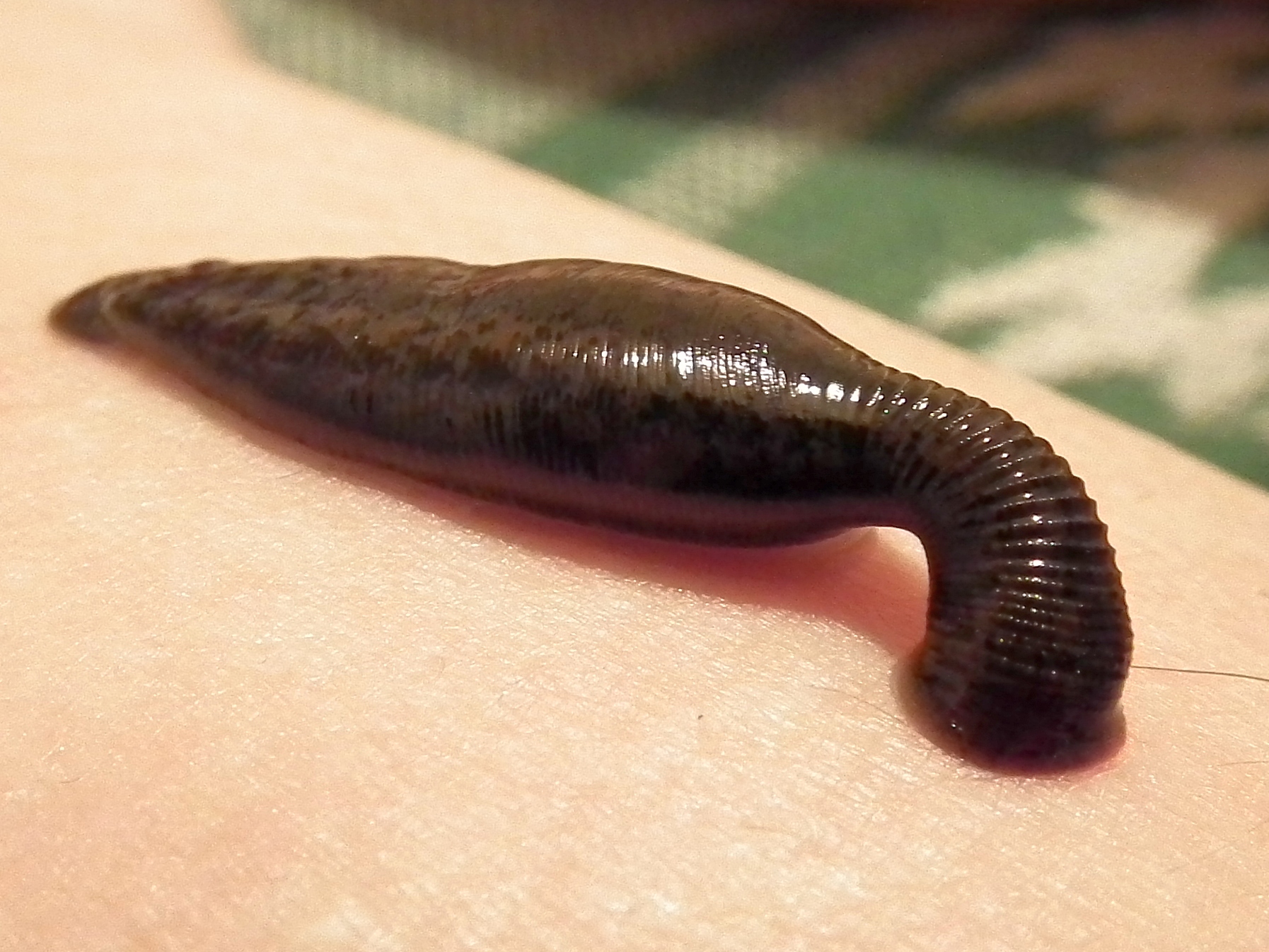 Leech Therapy | Can Leeches Kill You