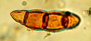 File:Ascospore fossil.jpg