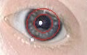 The Brushfield spots are the spots between the inner and outer red circles. Brushfield eyes magnified.jpg