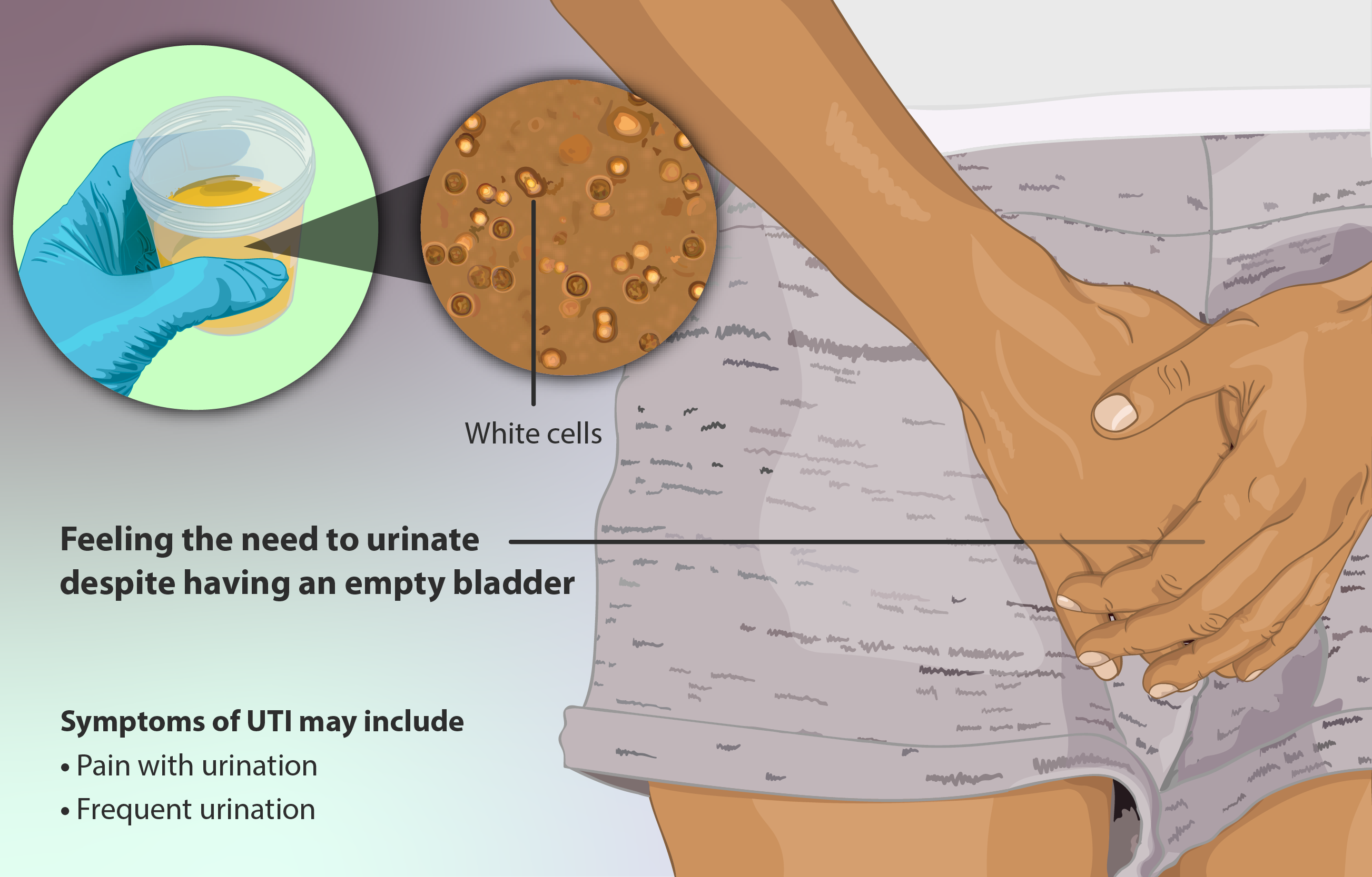 File:Depiction of a lady who has a Urinary Tract Infection (UTI).png -  Wikimedia Commons