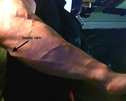 File:Basilic Vein.jpg