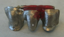 The abutment and pontic joined with acrylic resin in a solder index and reinforced with an old bur (lying horizontally across the occlusal surface of the copings). Post-solder index.jpg