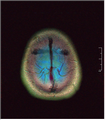 An APNG of an MRI scan of a human head
