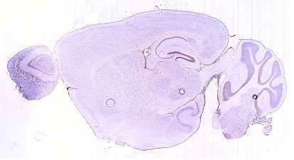 File:C9orf152 Brain Expression.jpg