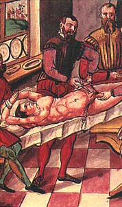 The procedure of castration as punishment during the 16th century Castration.jpg