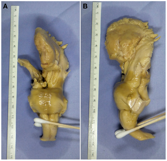 Histomorphometrical evaluation of zebrafish testes after in vivo