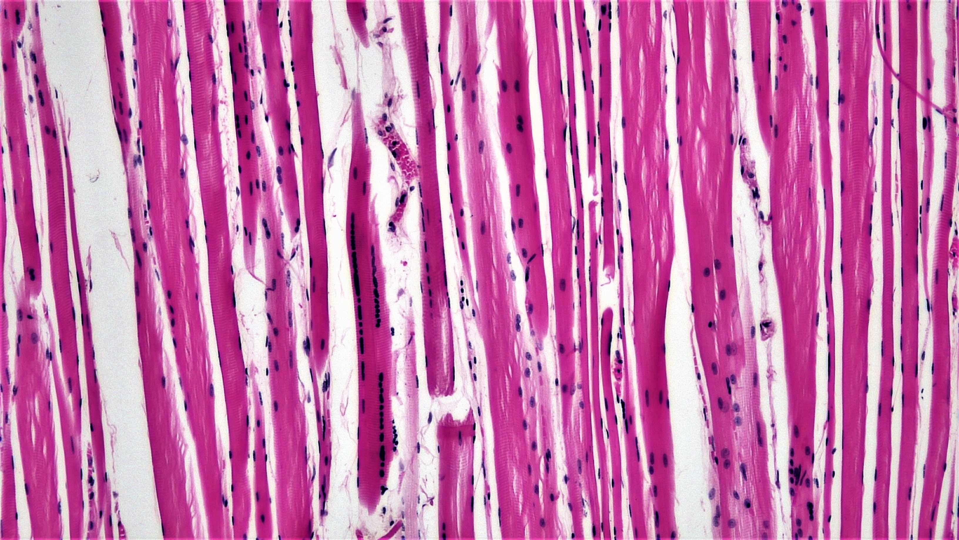 Изображение поперечно полосатой мышечной ткани. Поперечнополосатая сердечная мышечная ткань. Поперечно полосатая мышечная ткань гистология. Исчерченная сердечная мышечная ткань. Поперечно-полосатая сердечная мышечная ткань гистология.