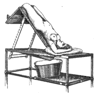 File:Position Trendelenburg.jpg