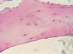 File:Cartilage.jpg