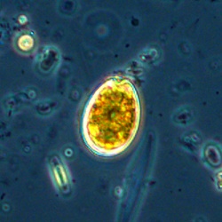 Dinoflagellate