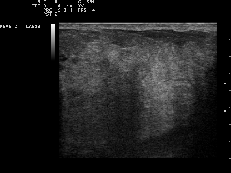 File:Ultrasound Scan ND 0124100109 1007080.png