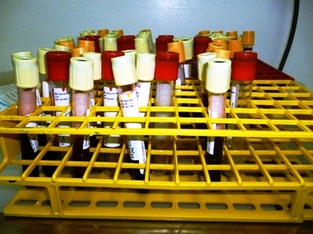 Blood in tubes (9617266704).jpg