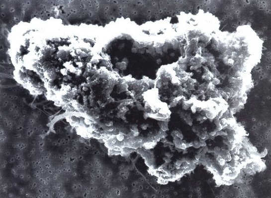 File:Comet dust microscopic photo.jpg