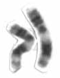 <span class="mw-page-title-main">Chromosome 11</span> Human chromosome