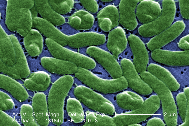 File:Vibrio vulnificus 01.png