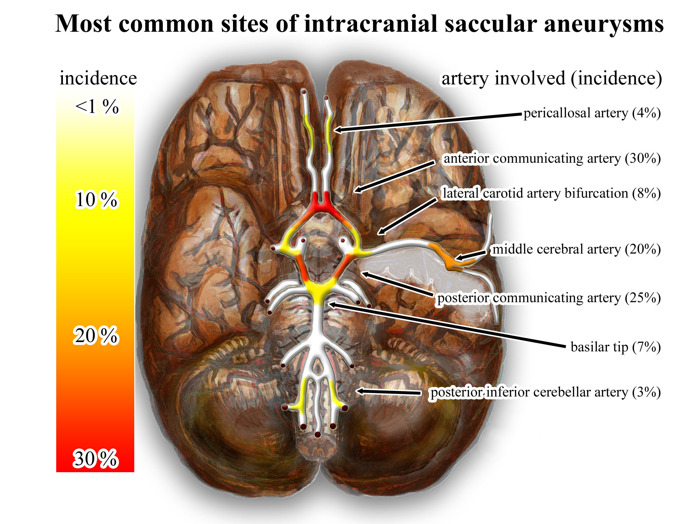 intracranial aneurysms - inferior view - heat map