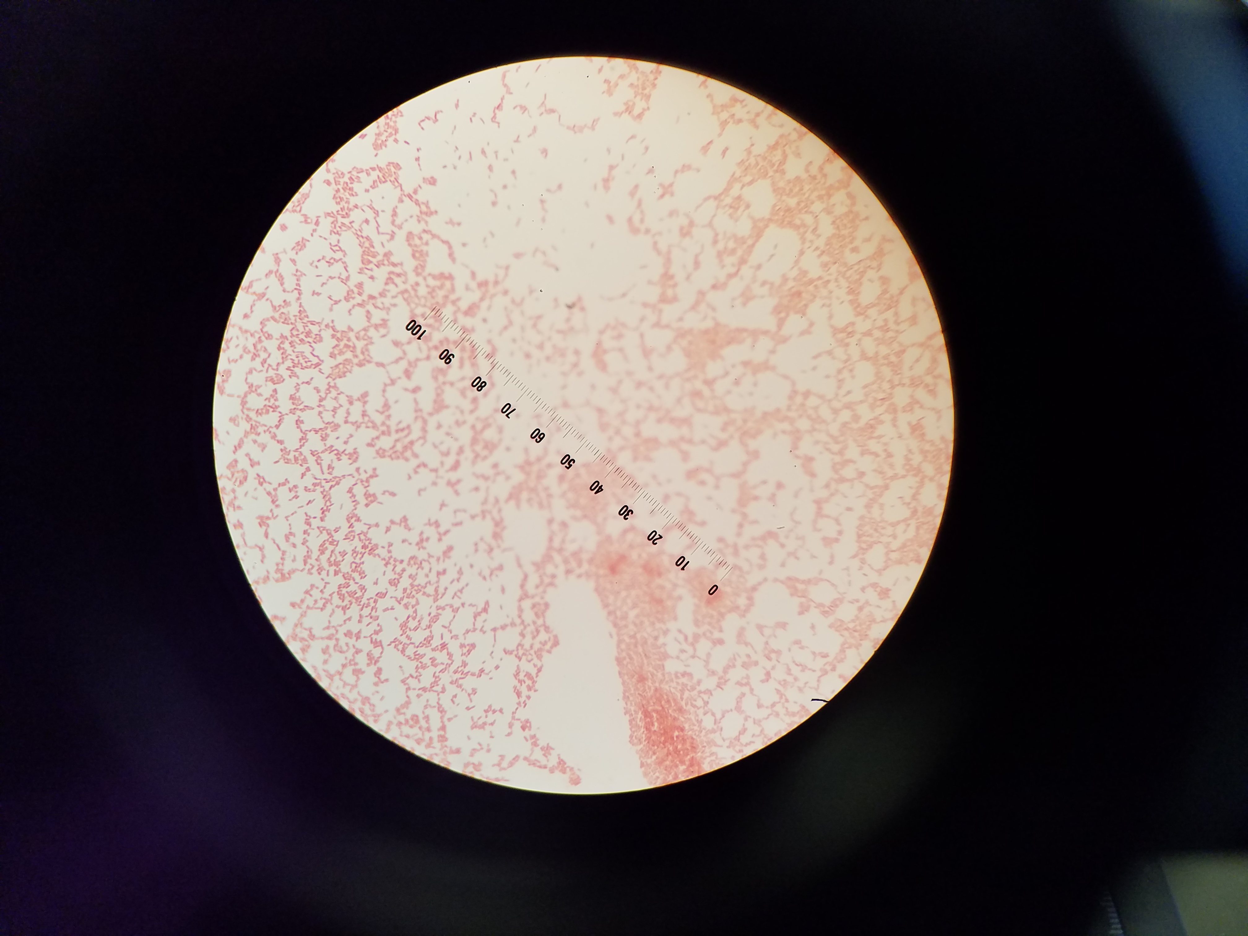 Escherichia coli under microscope 100x