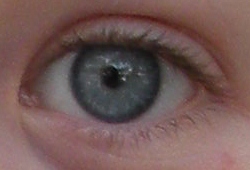 File:Limbal ring (2).JPG