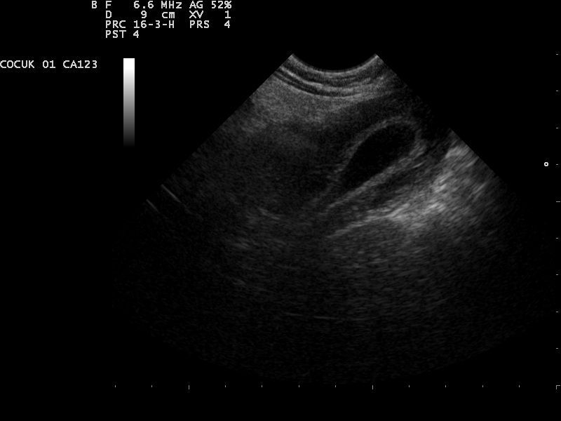 File:Ultrasound Scan ND 0112101745 1023000.png