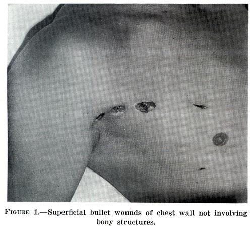 File:Chapter1figure1-Superficial bullet wound.jpg