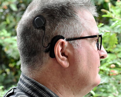 File:Cochlear implant user.jpg