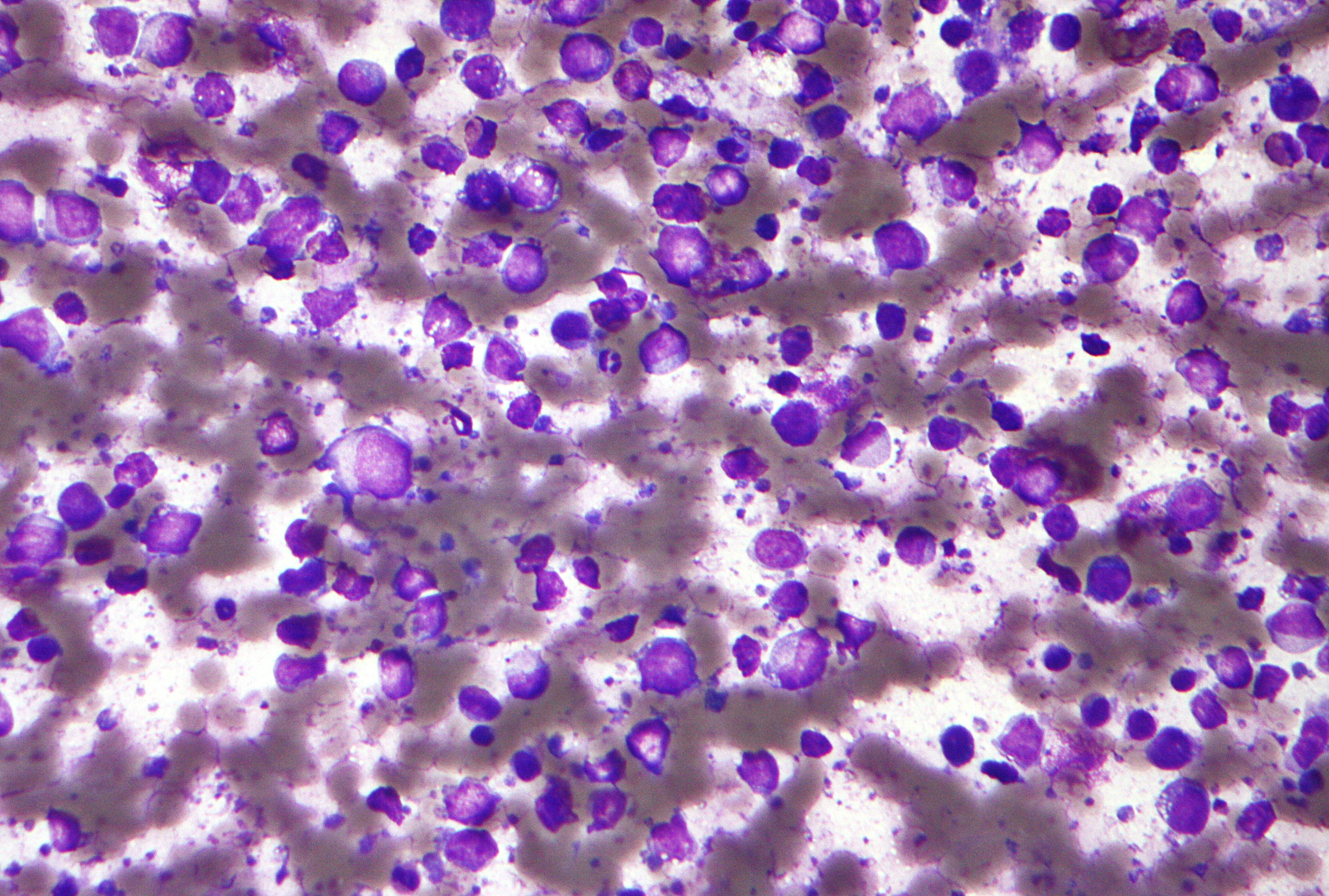 b lymphocytes under a microscope