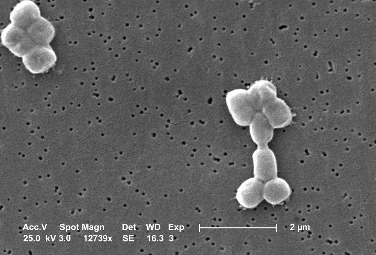 Enterococcus faecalis в сперме и проблемы с потенцией и либидо Лечение