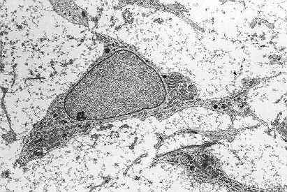 Mesenchymal-Stem-Cell-rotate