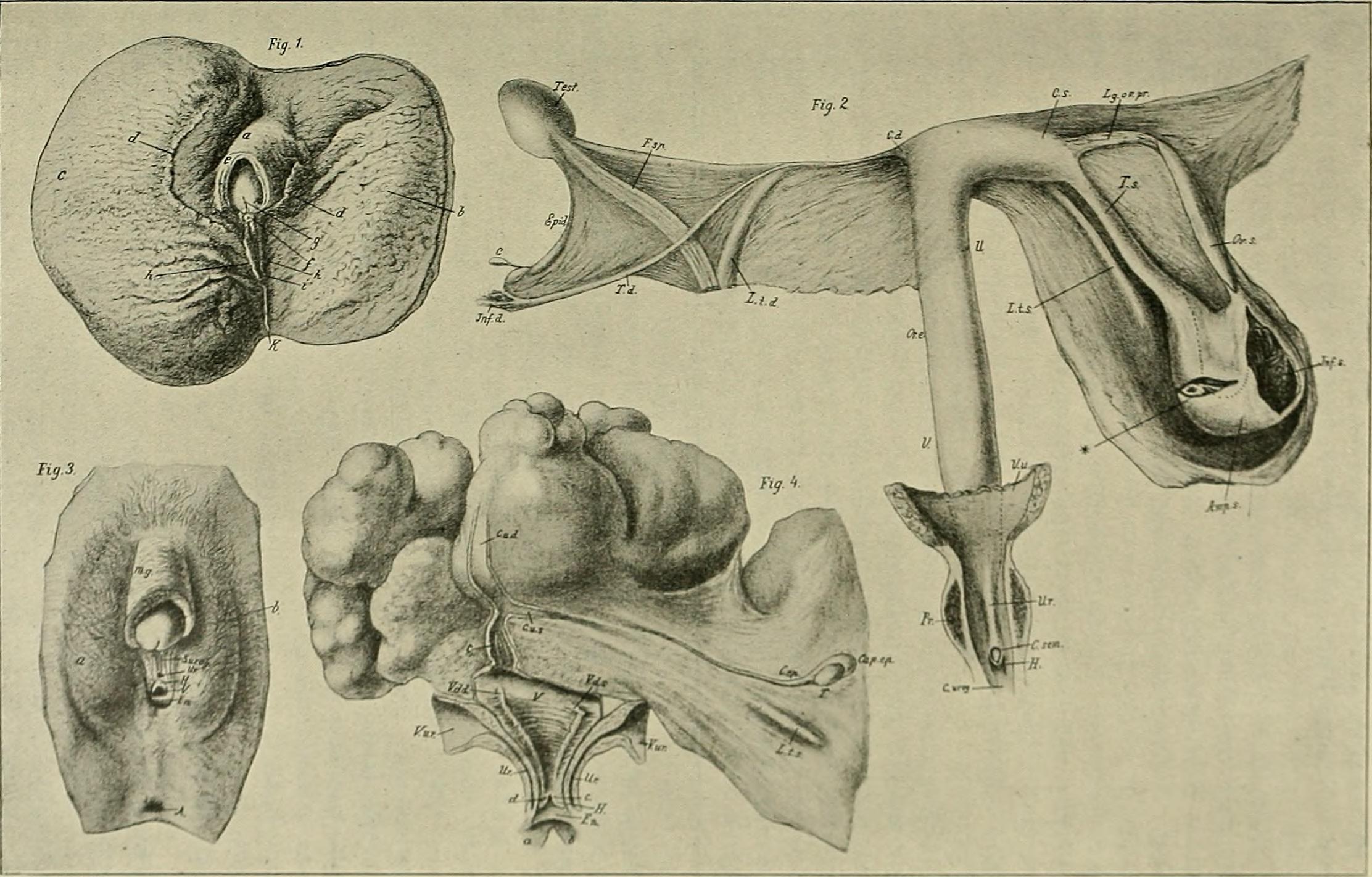 Hermaphroditismus beim Menschen (1908) (14597095978).jpg. 