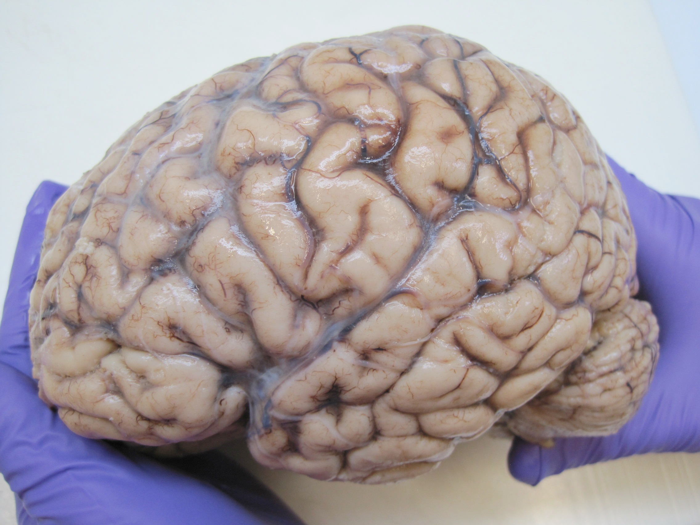 Human brain - Wikipedia
