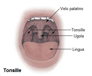 File:Tonsille diag.jpg