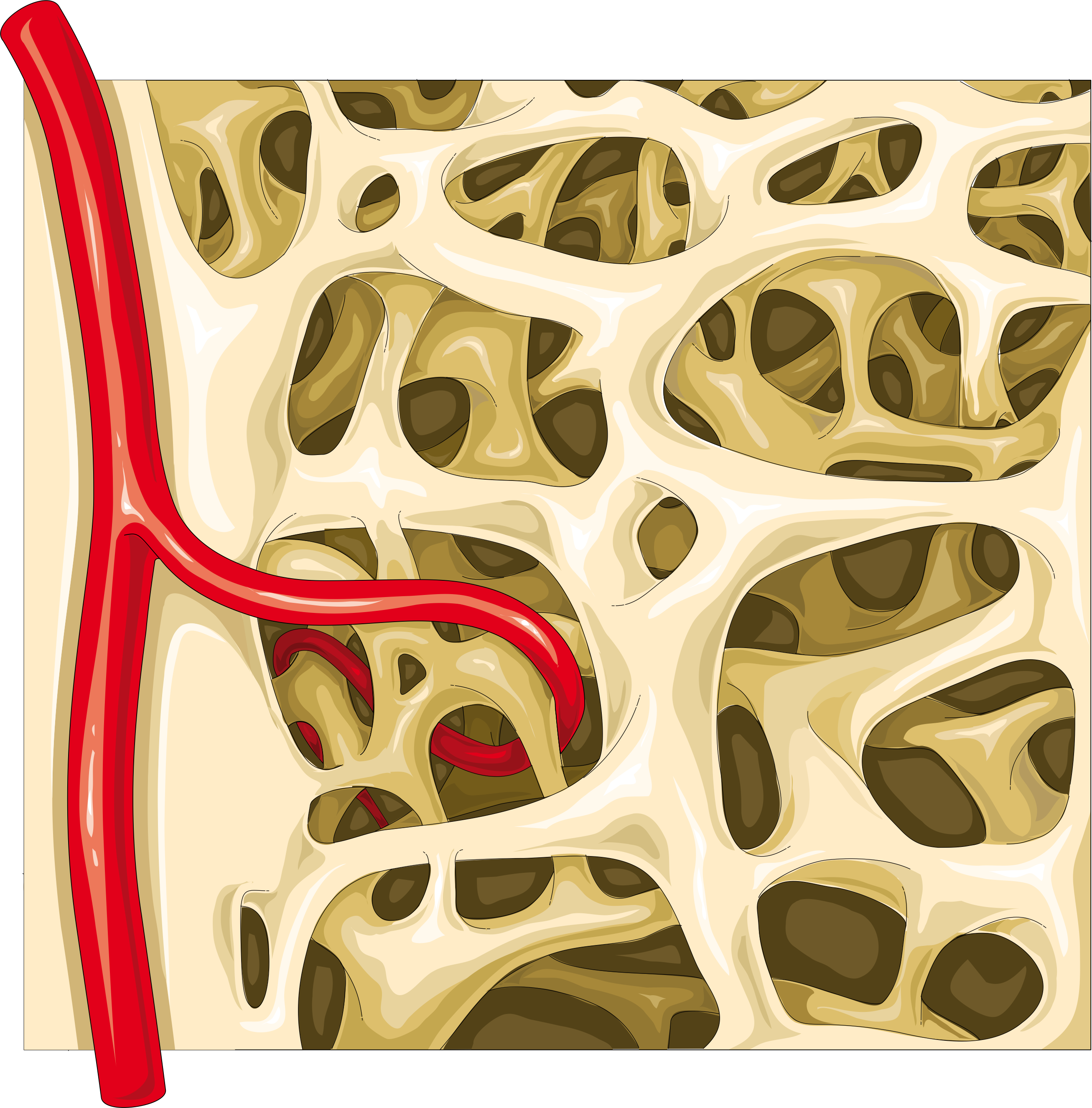 Костная рисунок. Spongy Bone. Трабекулярная кость. Трабекулярная ткань. Трабекулярный рисунок.