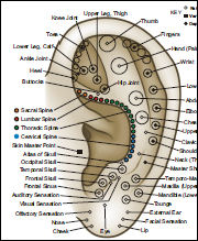 Auriculotherapy